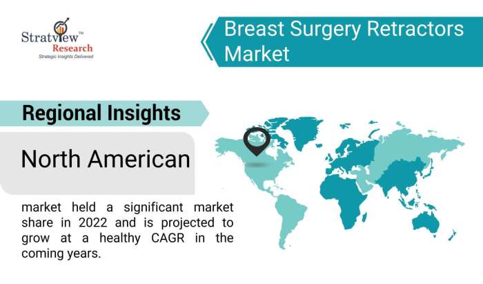 Breast-Surgery-Retractors-Market-Regional-Insights